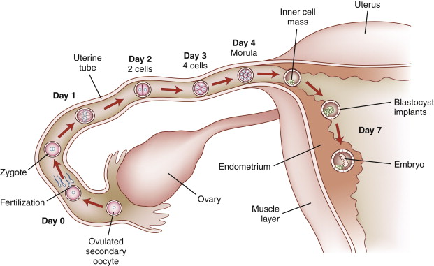 ICSI embryo transfer